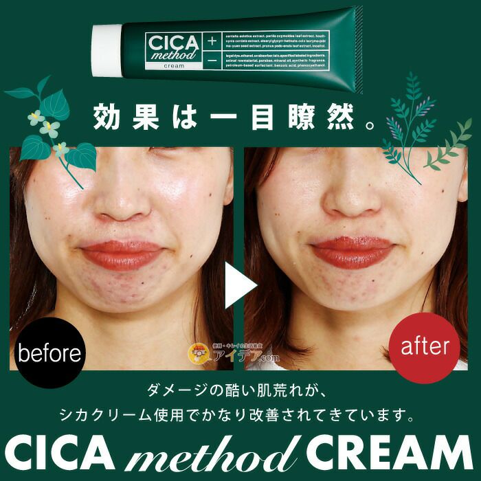 CICA method CREAM 50g [コジット] | コジット公式ストア アイデア.com